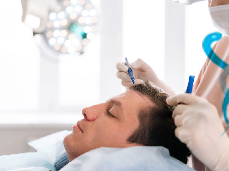 Ankara’da Saç Ekim