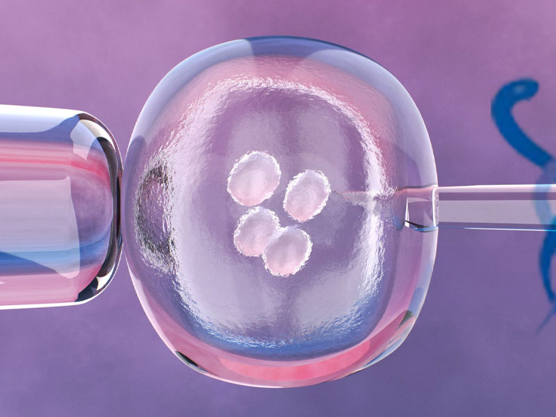 Ankara'da Özel Tüp Bebek Merkezi