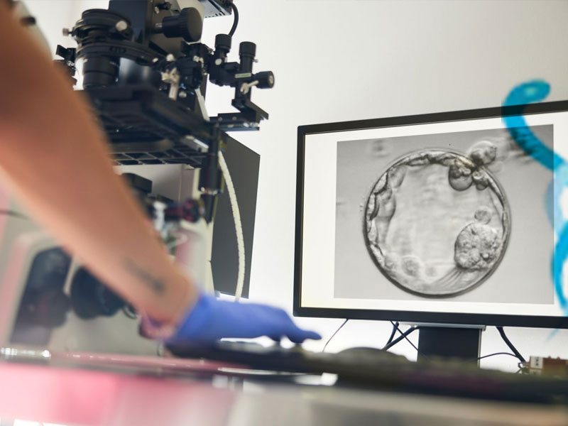 Tüp Bebek Nedir, Tüp Bebek Tedavisi Nasıl Yapılır?